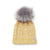 The Smartwool Lodge Girl Beanie is a cozy yellow Merino wool hat with white speckles, topped with a fluffy faux fur pom-pom and finished with a small logo tag near the brim.