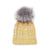 The Smartwool Lodge Girl Beanie is a yellow knit hat with a folded brim, topped with a large gray faux fur pom-pom and finished with a small white tag featuring a black logo on the brim.